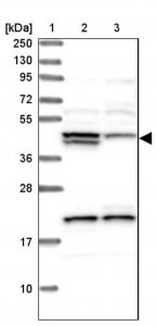 Anti-HERPUD1 antibody produced in rabbit 
