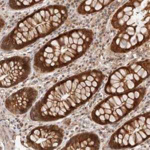 Anti-HEXDC antibody produced in rabbit 