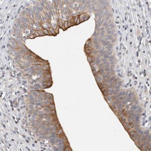 Anti-HEXDC antibody produced in rabbit HPA022834-100UL