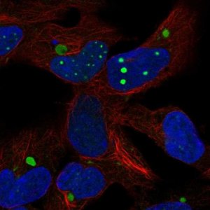 Anti-HEY2 antibody produced in rabbit 