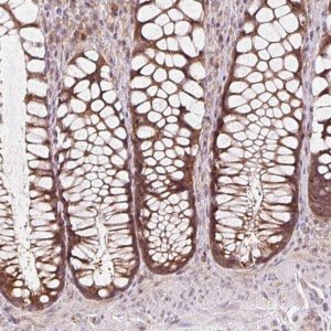 Anti-HFE antibody produced in rabbit HPA053470-100UL