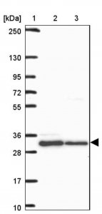 Anti-HFE antibody produced in rabbit HPA053470-100UL