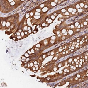 Anti-HGF antibody produced in rabbit 