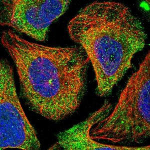 Anti-HGF antibody produced in rabbit 