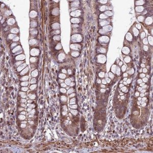 Anti-HGH1 antibody produced in rabbit 