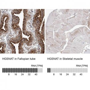 Anti-HGSNAT antibody produced in rabbit 