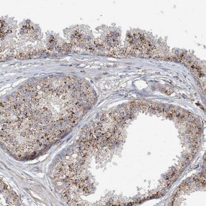 Anti-HGSNAT antibody produced in rabbit 