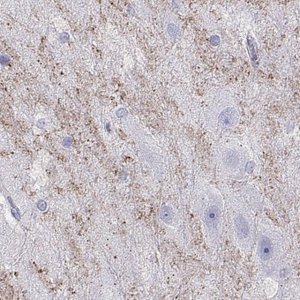 Anti-HHLA1 antibody produced in rabbit 