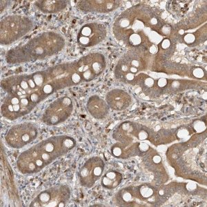 Anti-HHLA3 antibody produced in rabbit 