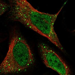 Anti-HHLA3 antibody produced in rabbit 
