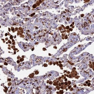 Anti-HIC1 antibody produced in rabbit 