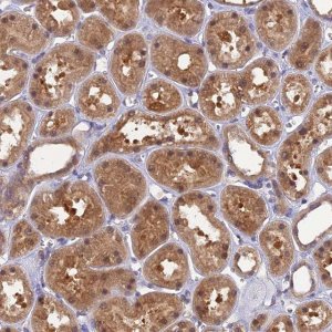 Anti-HINT1 antibody produced in rabbit 