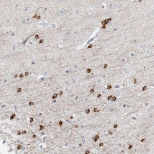 Anti-HIPK4 antibody produced in rabbit 