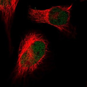 Anti-HIRA antibody produced in rabbit 