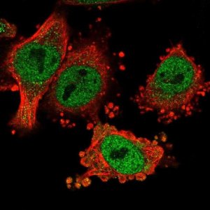 Anti-HMBOX1 antibody produced in rabbit 