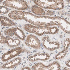 Anti-HMBS antibody produced in rabbit 
