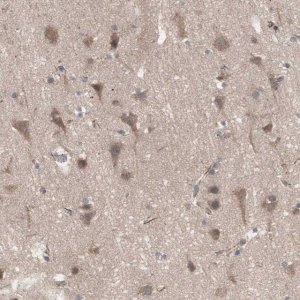Anti-HMBS antibody produced in rabbit 