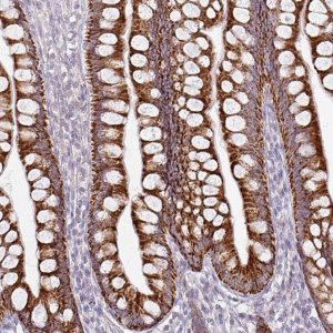 Anti-HMCN1 antibody produced in rabbit 