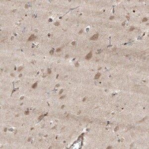 Anti-HMGCR antibody produced in rabbit 