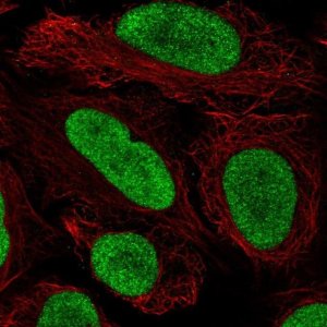 Anti-HMGN2 antibody produced in rabbit 