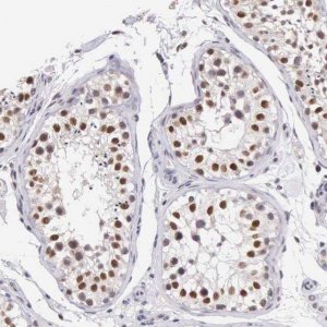 Anti-HMGXB4 antibody produced in rabbit 
