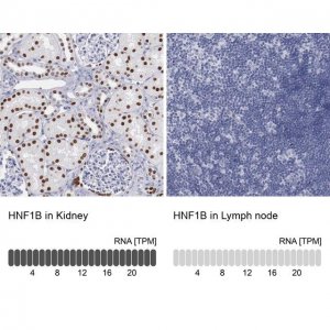Anti-HNF1B antibody produced in rabbit 