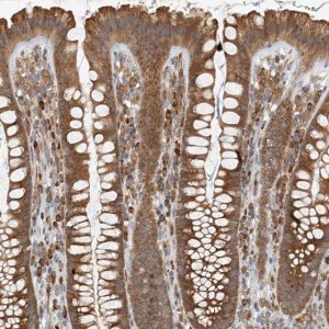 Anti-HNMT antibody produced in rabbit HPA035481-100UL
