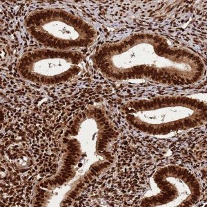 Anti-HNRNPAB antibody produced in rabbit HPA046688-100UL