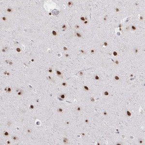 Anti-HNRNPDL antibody produced in rabbit 