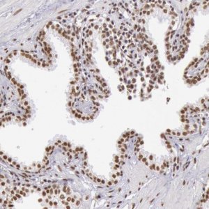 Anti-HNRNPH2 antibody produced in rabbit 
