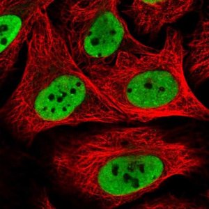 Anti-HNRNPK antibody produced in rabbit HPA044105-100UL