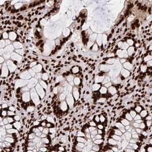 Anti-HNRNPL antibody produced in rabbit 