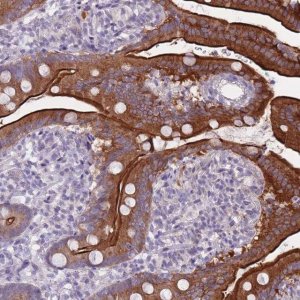 Anti-HOOK2 antibody produced in rabbit 
