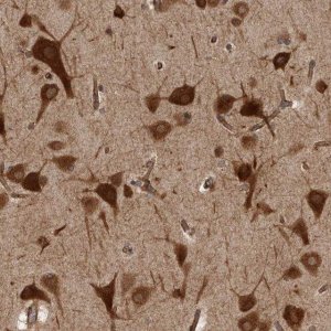 Anti-HOOK3 antibody produced in rabbit 