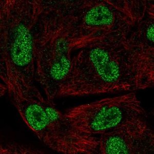 Anti-HORMAD1 antibody produced in rabbit 