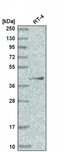 Anti-HOXA13 antibody produced in rabbit HPA046098-100UL