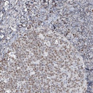 Anti-HOXA3 antibody produced in rabbit 