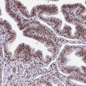 Anti-HOXA4 antibody produced in rabbit HPA060088-100UL