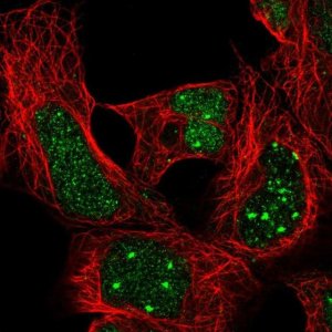 Anti-HOXA4 antibody produced in rabbit HPA060088-100UL