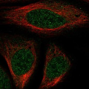 Anti-HOXA7 antibody produced in rabbit 