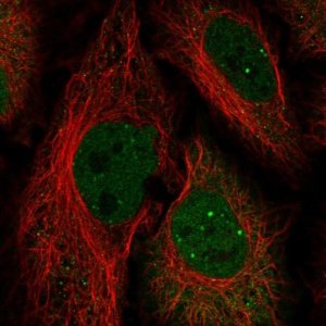 Anti-HOXC10 antibody produced in rabbit 