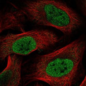 Anti-HOXC6 antibody produced in rabbit 