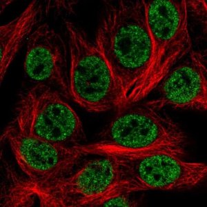 Anti-HOXD1 antibody produced in rabbit 