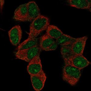 Anti-HOXD9 antibody produced in rabbit 