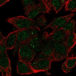 Anti-HP antibody produced in rabbit HPA047750-100UL