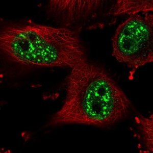 Anti-HP1BP3 antibody produced in rabbit 