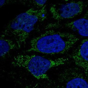 Anti-HPDL antibody produced in rabbit 