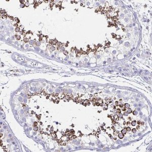 Anti-HRASLS2 antibody produced in rabbit 