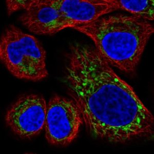 Anti-HRASLS2 antibody produced in rabbit 