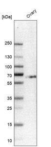 Anti-HS6ST2 antibody produced in rabbit HPA034626-100UL